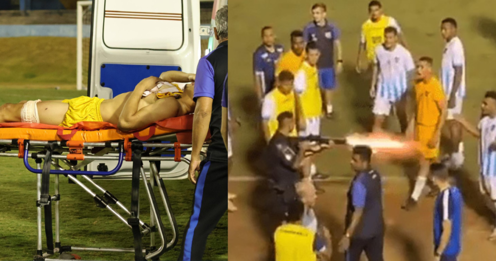 Jogador é baleado após jogo