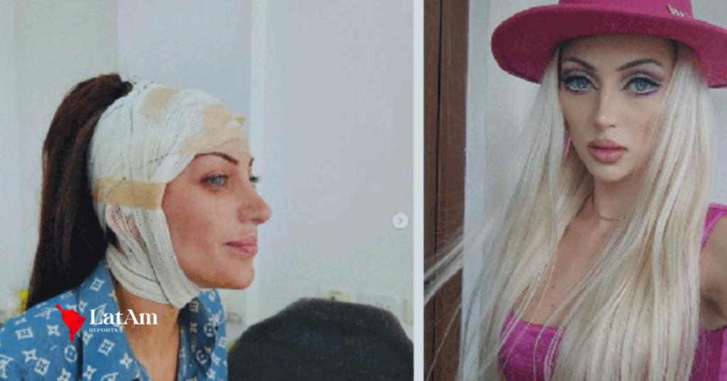 'Barbie humana': laudos indicam morte acidental por uso de cocaína, afirma investigação