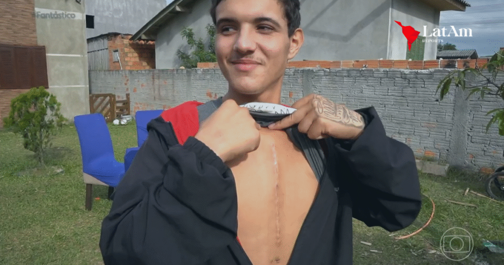Jovem sobrevive após prego atingir o coração e emociona ao descrever cirurgia: “Nasci de novo”