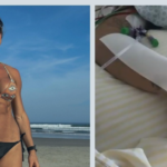 Influencer com lesão na coluna após mergulho em Maresias volta a mexer braço direito após uso experimental de polilaminina