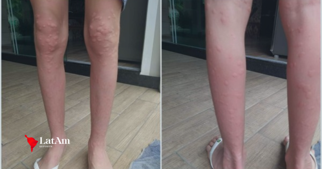 Mosquito minúsculo faz moradores de SC se trancarem em casa e usarem casaco com 30°C