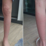 Mosquito minúsculo faz moradores de SC se trancarem em casa e usarem casaco com 30°C